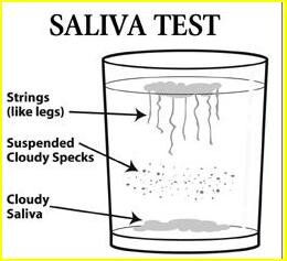 Easy Saliva Test for Candida Overgrowth