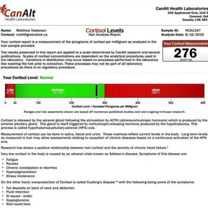 Hair Cortisol Analysis
